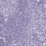 TNNI2 Antibody in Immunohistochemistry (Paraffin) (IHC (P))