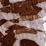 TNNI2 Antibody in Immunohistochemistry (Paraffin) (IHC (P))