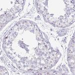 TNNI2 Antibody in Immunohistochemistry (Paraffin) (IHC (P))