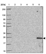 TNNI2 Antibody in Western Blot (WB)