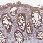 GSTM1 Antibody in Immunohistochemistry (Paraffin) (IHC (P))
