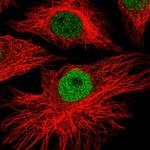 MEIS1 Polyclonal Antibody