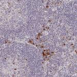 MEIS1 Antibody in Immunohistochemistry (Paraffin) (IHC (P))