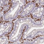 MEIS1 Antibody in Immunohistochemistry (Paraffin) (IHC (P))