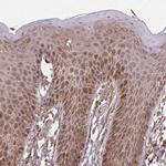 ZNF219 Antibody in Immunohistochemistry (Paraffin) (IHC (P))
