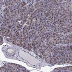 ARFGAP1 Antibody in Immunohistochemistry (Paraffin) (IHC (P))