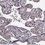 ARFGAP1 Antibody in Immunohistochemistry (Paraffin) (IHC (P))