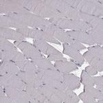 ARFGAP1 Antibody in Immunohistochemistry (Paraffin) (IHC (P))