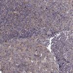ARFGAP1 Antibody in Immunohistochemistry (Paraffin) (IHC (P))