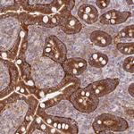 MINK1 Antibody in Immunohistochemistry (Paraffin) (IHC (P))