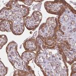MINK1 Antibody in Immunohistochemistry (Paraffin) (IHC (P))