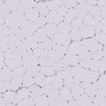 MINK1 Polyclonal Antibody