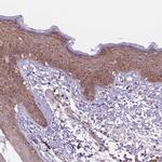 MINK1 Antibody in Immunohistochemistry (Paraffin) (IHC (P))