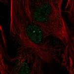 FOXC2 Polyclonal Antibody