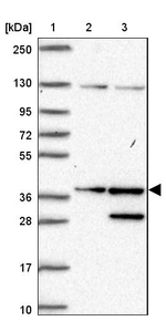 SGTA Antibody in Western Blot (WB)