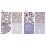 FUCA1 Polyclonal Antibody