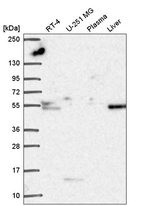 FUCA1 Antibody in Western Blot (WB)