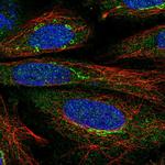RyR1 Antibody in Immunocytochemistry (ICC/IF)
