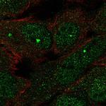 FAM106A Polyclonal Antibody