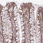 FAM106A Antibody in Immunohistochemistry (Paraffin) (IHC (P))