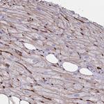 CITED4 Antibody in Immunohistochemistry (Paraffin) (IHC (P))