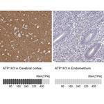 ATP1A3 Antibody