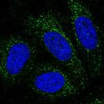PBX4 Polyclonal Antibody