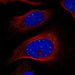 GRF-1 Polyclonal Antibody