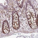 GRF-1 Antibody in Immunohistochemistry (Paraffin) (IHC (P))