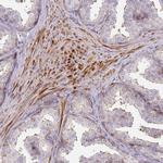 GRF-1 Antibody in Immunohistochemistry (Paraffin) (IHC (P))