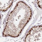 GRF-1 Antibody in Immunohistochemistry (Paraffin) (IHC (P))