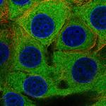 PFKP Polyclonal Antibody