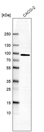 PFKP Antibody in Western Blot (WB)