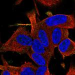 RGS17 Polyclonal Antibody
