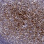 FCAMR Antibody in Immunohistochemistry (Paraffin) (IHC (P))