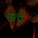 NLK Polyclonal Antibody