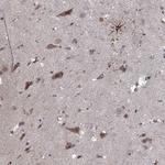 NLK Antibody in Immunohistochemistry (Paraffin) (IHC (P))