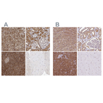 PACSIN2 Polyclonal Antibody