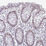 RBL1 Antibody in Immunohistochemistry (Paraffin) (IHC (P))