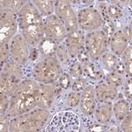 RBL1 Antibody in Immunohistochemistry (Paraffin) (IHC (P))