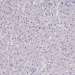 RBL1 Antibody in Immunohistochemistry (Paraffin) (IHC (P))