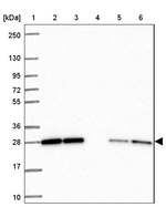 RBL1 Antibody in Western Blot (WB)