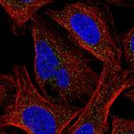 CK1 gamma-2 Polyclonal Antibody