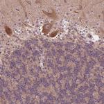 CK1 gamma-2 Antibody in Immunohistochemistry (Paraffin) (IHC (P))