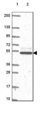CK1 gamma-2 Antibody in Western Blot (WB)