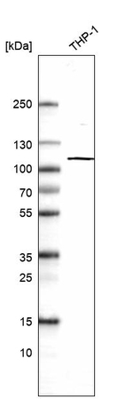 HK3 Antibody in Western Blot (WB)