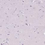 SFTPD Antibody in Immunohistochemistry (Paraffin) (IHC (P))