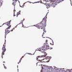 SFTPD Antibody in Immunohistochemistry (Paraffin) (IHC (P))