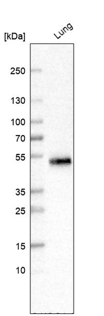 SFTPD Antibody in Western Blot (WB)