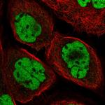 DPF2 Antibody in Immunocytochemistry (ICC/IF)